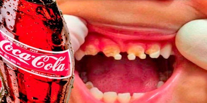 “Coca-Cola” – içki, yoxsa xəstəlik mənbəyi? - VİDEO
