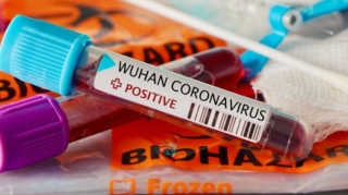 Daha 9 şagird koronavirusa yoluxub