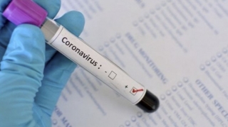ABŞ-da son sutkada koronavirusdan 930 nəfər ölüb