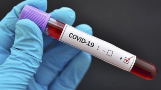Rusiyada son sutkada 6 234 nəfər koronavirusa yoluxub