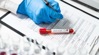 Deputatların növbəti koronavirus testinin nəticəsi açıqlandı