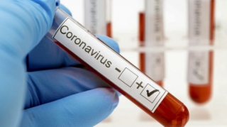 Azərbaycanda koronavirusa yoluxma 200-dən aşağı düşdü, 3-ü vəfat edib 