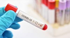 Azərbaycanda daha 38 nəfər koronavirusa yoluxub, 30 nəfər sağalıb