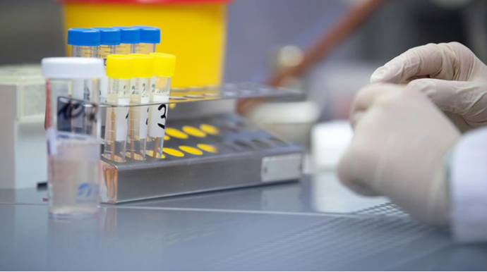 Daha bir təhlükəli virus YAYILIR - ÖLƏNLƏR VAR 