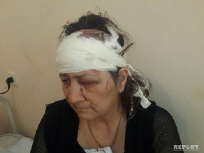 Sumqayıt sakini qayınanasını döyüb - FOTO