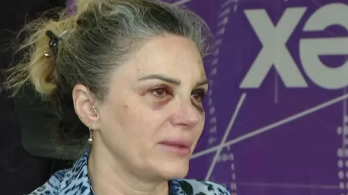 Keçmiş iş yoldaşı tərəfindən döyülən qadın DANIŞDI - VİDEO
