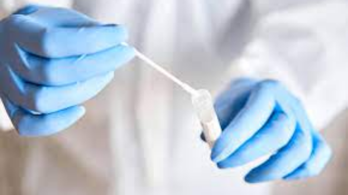 Vətəndaşlardan COVID-19 testi niyə iki dəfə götürülür? - RƏSMİ AÇIQLAMA 