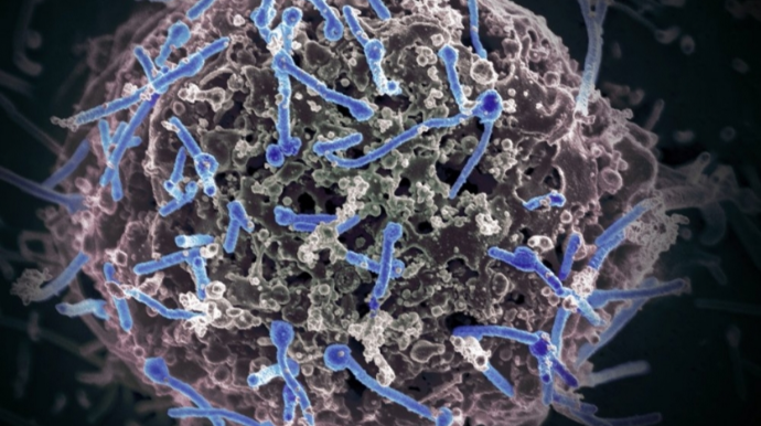 Qlobal istiləşmə virusları daha dayanıqlı edəcək