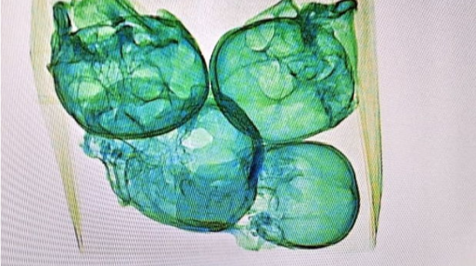 Meksikada aeroportda bağlamadan insan kəllələri çıxdı - FOTO 