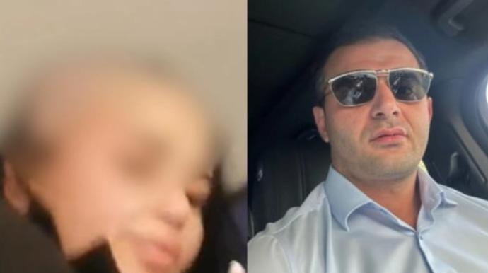 Həyat yoldaşının başını keçəl edən şəxs saxlanıldı - FOTO