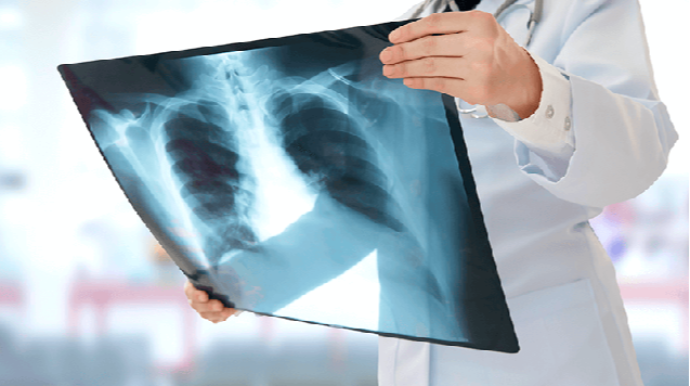 Rentgen müayinəsinə gedərkən DİQQƏTLİ OLUN!  - Nazirlik əhaliyə MÜRACİƏT ETDİ   - VİDEO