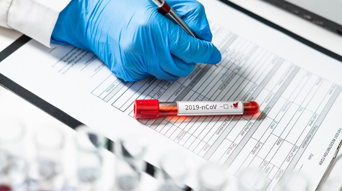 ÜST:   Fövqəladə vəziyyət davam etməlidir