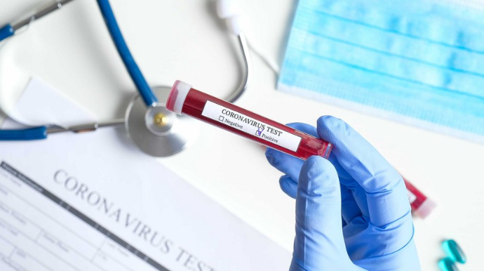 Azərbaycanda daha 220 nəfər koronavirusa yoluxub