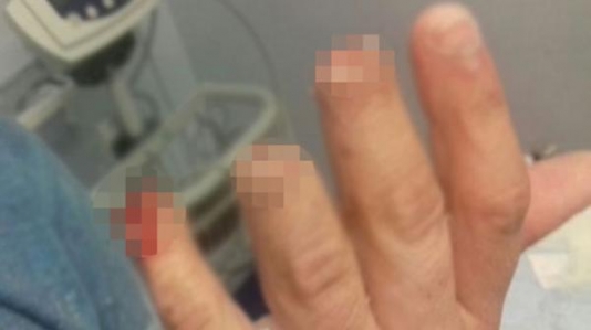 Polisdən dəhşətli işgəncə: Lüt soyundurub barmaqlarını qırdılar - VİDEO