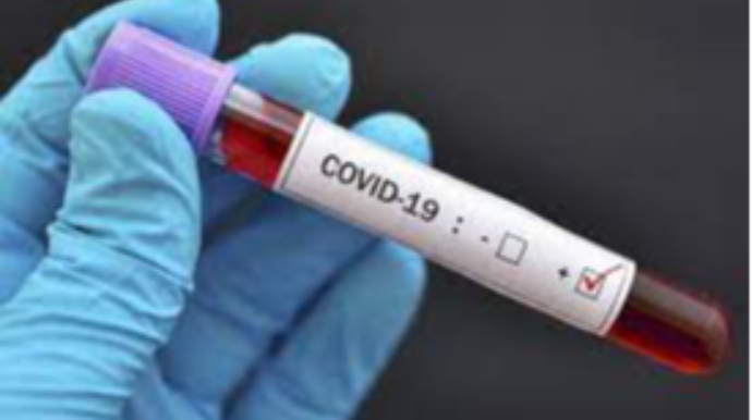 Azərbaycanda daha 31 nəfər COVID-19-a yoluxdu