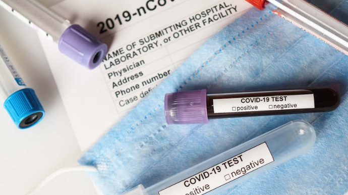 Azərbaycanda daha 28 şagird və 9 müəllim koronavirusa yoluxub