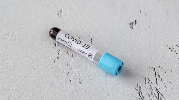 Koronavirusla bağlı SON STATİSTİKA 