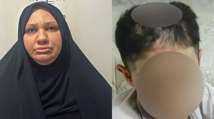 Xalası tərəfindən işgəncəyə məruz qalan yeniyetmə ilə bağlı YENİ XƏBƏR