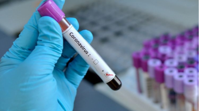 Dünyada koronavirusa yoluxanların sayı 26 milyonu ötüb