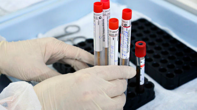 Koronavirusla bağlı SON STATİSTİKA 