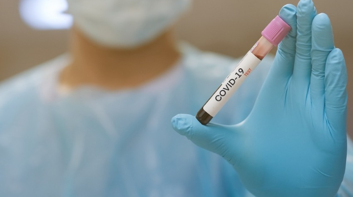 Son sutkada Azərbaycanda 325 nəfər koronavirusa yoluxub, 7 nəfər ölüb