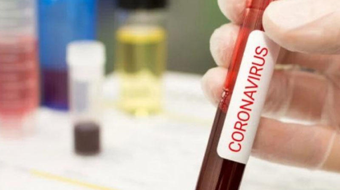 Dağlıq Qarabağda koronavirusa yoluxanların sayı 323 nəfər çatıb