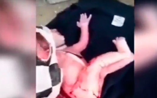 Bakıda şok görüntü - Zibillikdə körpə tapıldı - VİDEO - 18+