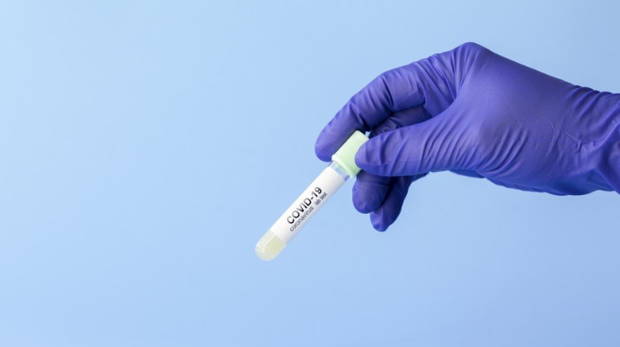 Azərbaycanda daha 802 nəfərdə koronavirus aşkarlanıb, 31 nəfər ölüb  - FOTO