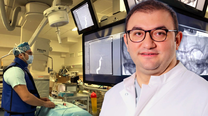 Beyin damarlarını 11 dəqiqəyə açan azərbaycanlı: "Hər şey bir anın içində oldu" - FOTO 