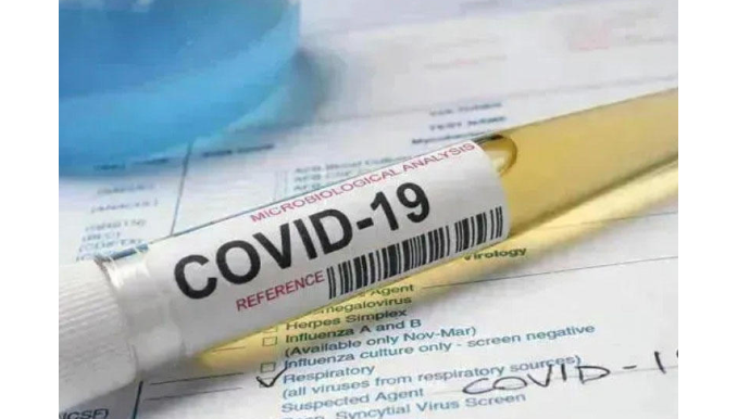 Выявлены 4 189 новых случаев инфицирования COVID-19