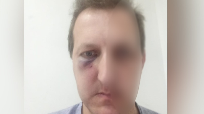 Xalq artistinin oğlu evə buraxıldı 