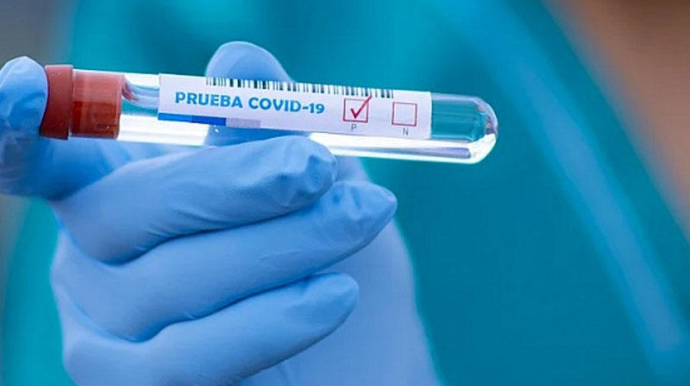 Dağlıq Qarabağda koronavirusa yoluxanların sayı 328-ə çatıb