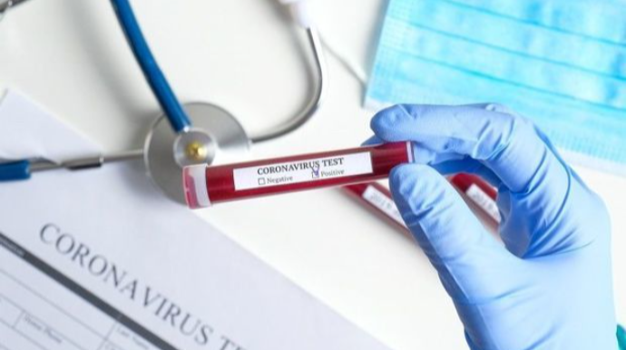 Koronavirusla bağlı SON STATİSTİKA 