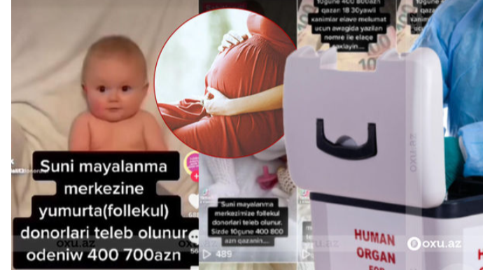 Azərbaycanda 800 manata orqan satışı: Qadınlar dönüşü olmayan təhlükə ilə üz-üzədirlər - ARAŞDIRMA   - FOTO