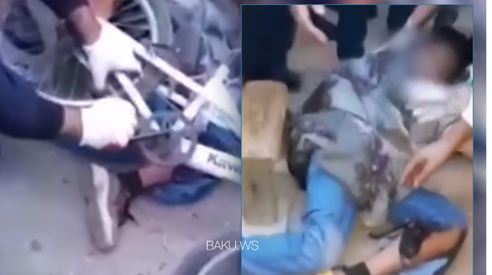 Velosiped 12 yaşlı oğlanın ayağını kəsdi - Bakıda - VİDEO 
