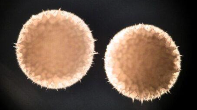 Qocalmanı yavaşladan dərman tapılıb - ARAŞDIRMA 