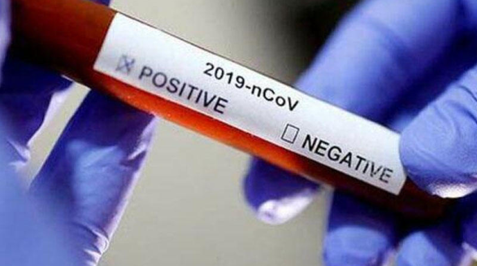 Həm koronavirusu, həm də qripi tapır - YENİ KƏŞF 