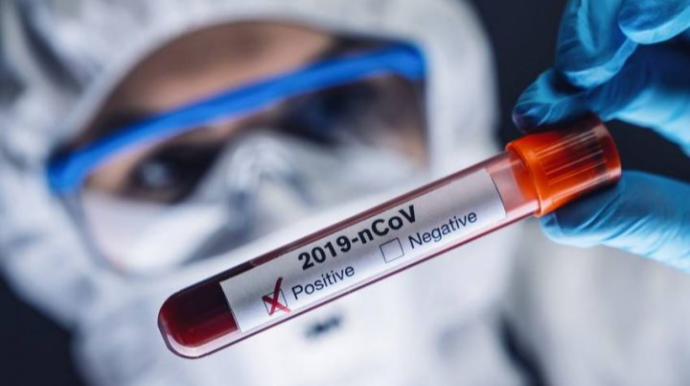 Azərbaycanda 3 nəfər koronavirusdan öldü  - FOTO