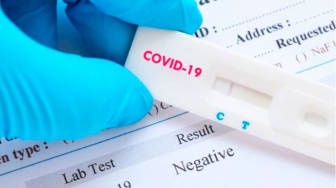 Azərbaycanda son sutkada 143 nəfər COVID-19-a yoluxub,  2 nəfər vəfat edib 