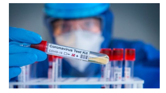 Azərbaycanda daha 2 749 nəfərdə koronavirus aşkarlanıb