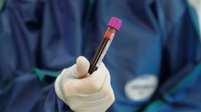 Azərbaycanda koronavirusdan daha doqquz nəfər öldü: 391 yeni yoluxma  - FOTO