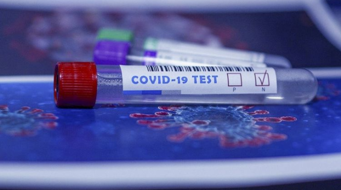 Azərbaycanda indiyədək 1 150 658 koronavirus testi aparılıb