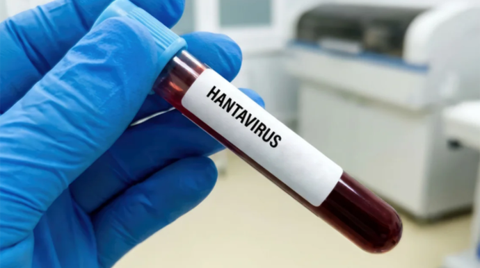 Hantavirus insandan insana nadir halda keçir - Rəsmi 