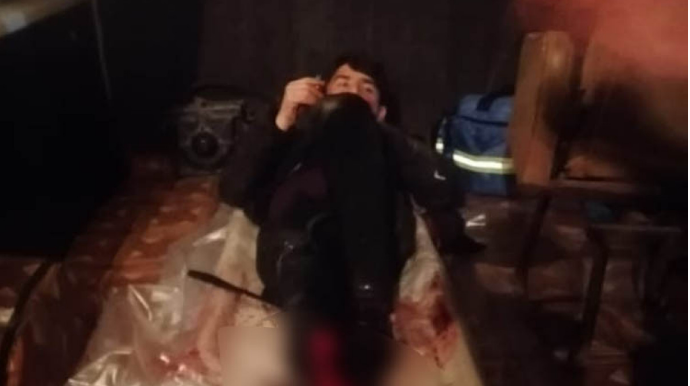 Gəncədə qatar kişini vuraraq ayağını kəsib - FOTO 