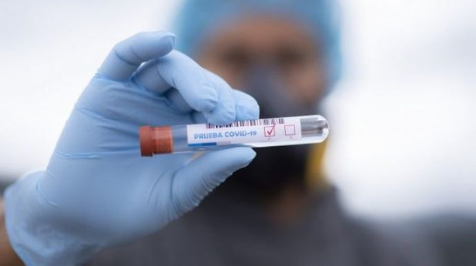 Azərbaycanda koronavirusdan ölənlərin sayı azaldı - FOTO