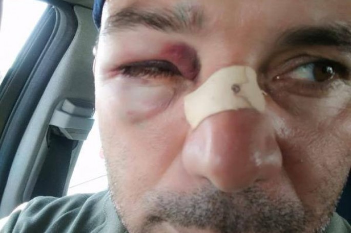 Bakıda jurnalistin döyülməsi faktı ilə əlaqədar cinayət işi başlanılıb