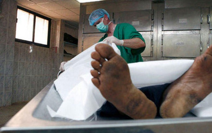 Göz həkimləri haqda şok iddia - Meyitlərin gözünü çıxarırlar