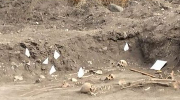Xocalıda kütləvi məzarlıq aşkarlandı - FOTO   - VİDEO