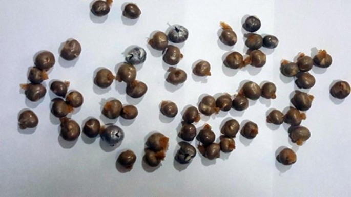 Vətəndaşın daxili orqanında narkotik vasitə və psixotrop maddə aşkarlandı