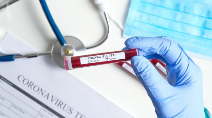 Azərbaycanda son sutkada 11 nəfər koronavirusa yoluxub, ölən olmayıb 